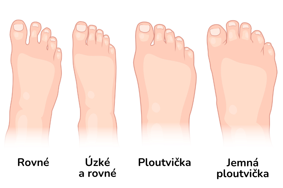 Typy chodidel - tvar chodidla